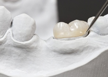 A metal-free dental crown restoration