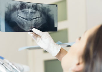 examining dental x-ray