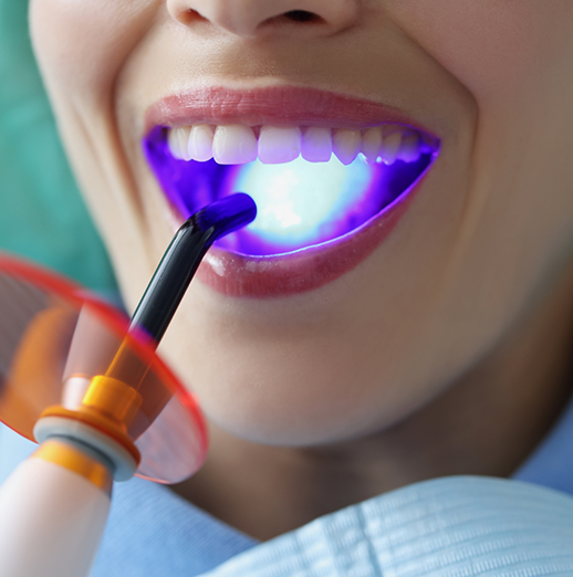 Smiling woman receiving dental bonding in Powell