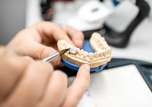 Dental laboratory worker designing a crown