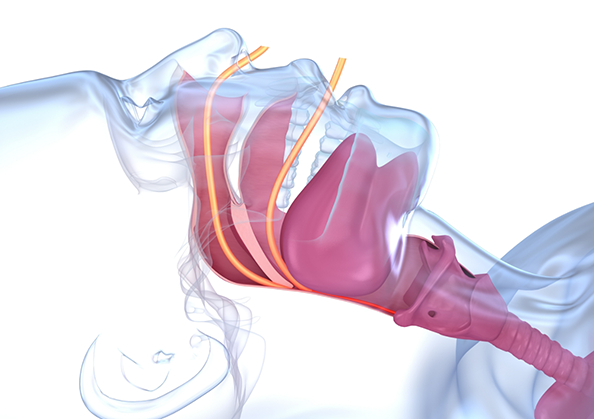 Illustration of the upper airway