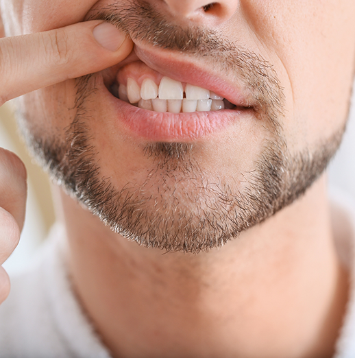Man pointing to his gums before gum disease treatment in Powell