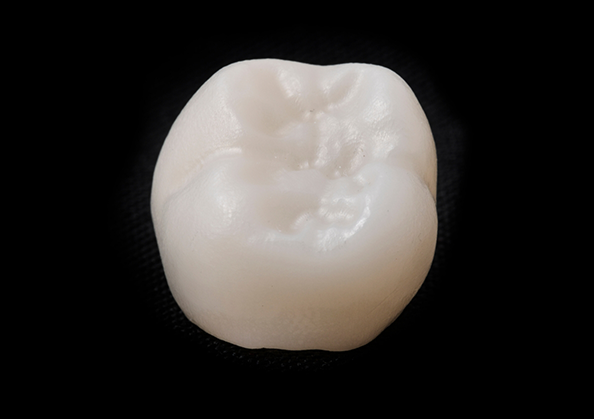 Tooth colored dental crown