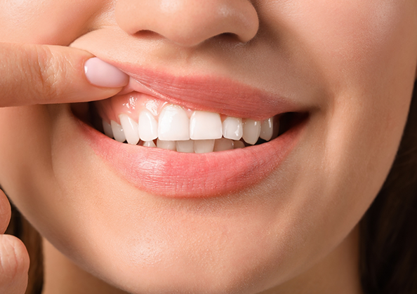 Close up of a person pointing to their gums