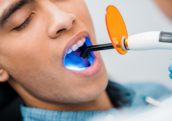Man having his tooth treated with an ultraviolet light