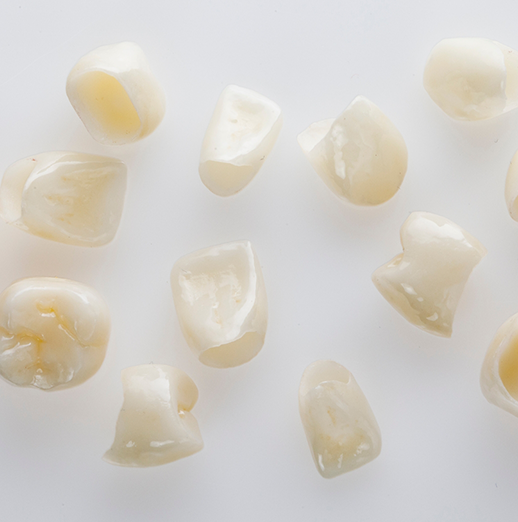 Several tooth colored dental crowns